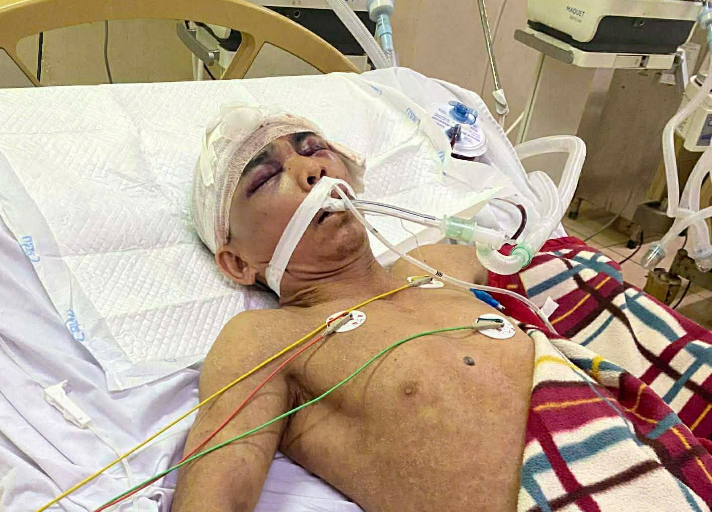 Thương tâm người đàn ông ở xã Hương Bình gặp nạn nguy kịch cần giúp đỡ